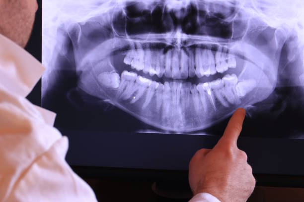 Best Emergency Treatment for Toothache in Brunswick, MD